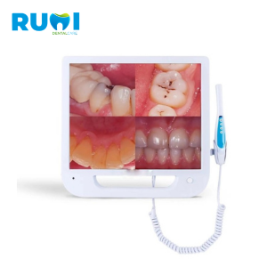 APPLE Intraoral Camera with Screen and TFT Clamp (1 Year Warranty)
